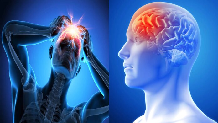 Symptoms of cerebral edema | తరచూ తలనొప్పి.. యమ డేంజర్.. సెరిబ్రల్ ఎడెమా లక్షణాలివి..